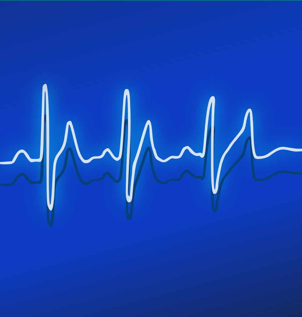 ekg heart monitor sound wave